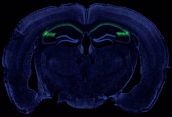 Scoperta 'l'area social' del cervello. Essenziale per memorizzare le relazioni sociali