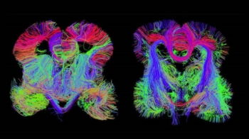 Scoperta la 'custodia' dei ricordi recenti. Conseguenze positive in cura epilessia e Alzheimer