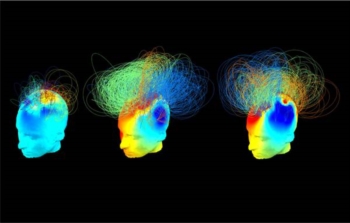 Scoperte 'firme' della coscienza nel cervello in stato vegetativo. Indicano la presenza di reti di neuroni ancora intatte