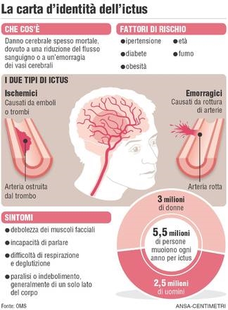 Ictus, scoperto farmaco che limita danni al 50% dopo 6 ore. Studio su modelli animali, 'Mario Negri' Milano e 'NICO' Torino