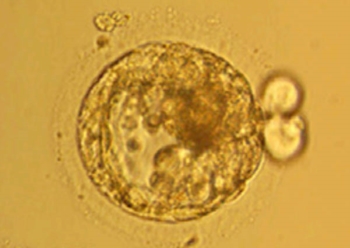 Clonate cellule umane prelevate da adulti. Primo successo, finora clonate solo cellule fetali