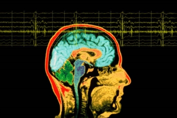 Un dispositivo nel cervello per controllare le emozioni. Due progetti in Usa e 70 milioni di dollari a disposizione