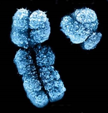 Il fumo 'cancella' il cromosoma maschile Y Il fumo 'cancella' il cromosoma maschile Y Il rischio triplica rispetto ai non fumatori