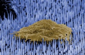 Nano-aghi per riparare organi e nervi danneggiati. Nei topi hanno generato nuovi vasi sanguigni